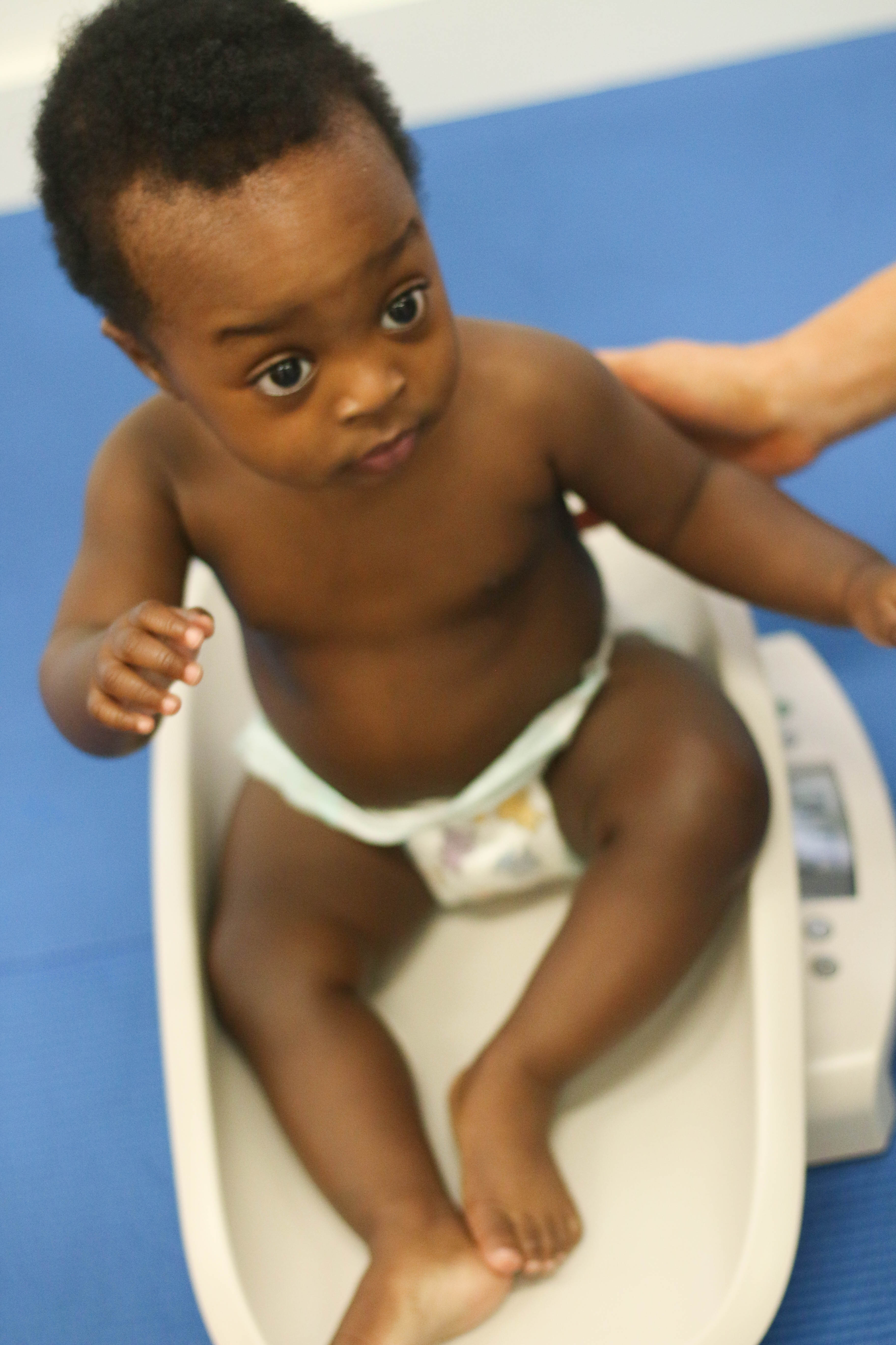 Underweight Children